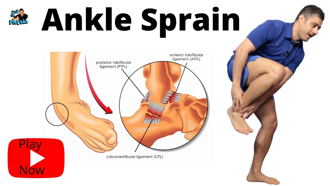 Ankle Sprain teratment early stage