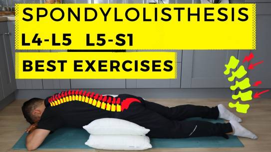Spondylolysis and Spondylolisthesis rehabilitation exercises