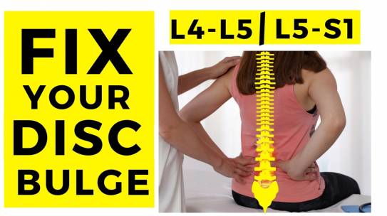 Does disc bulges heal and how long does it takes?