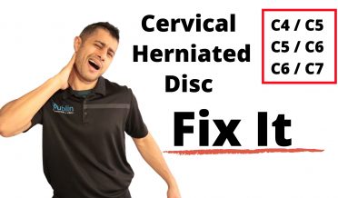 Cervical herniated disc exercises