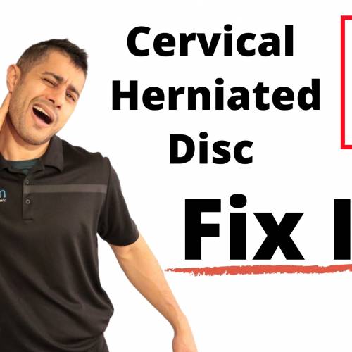 Cervical herniated disc exercises