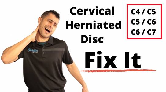 Cervical herniated disc exercises