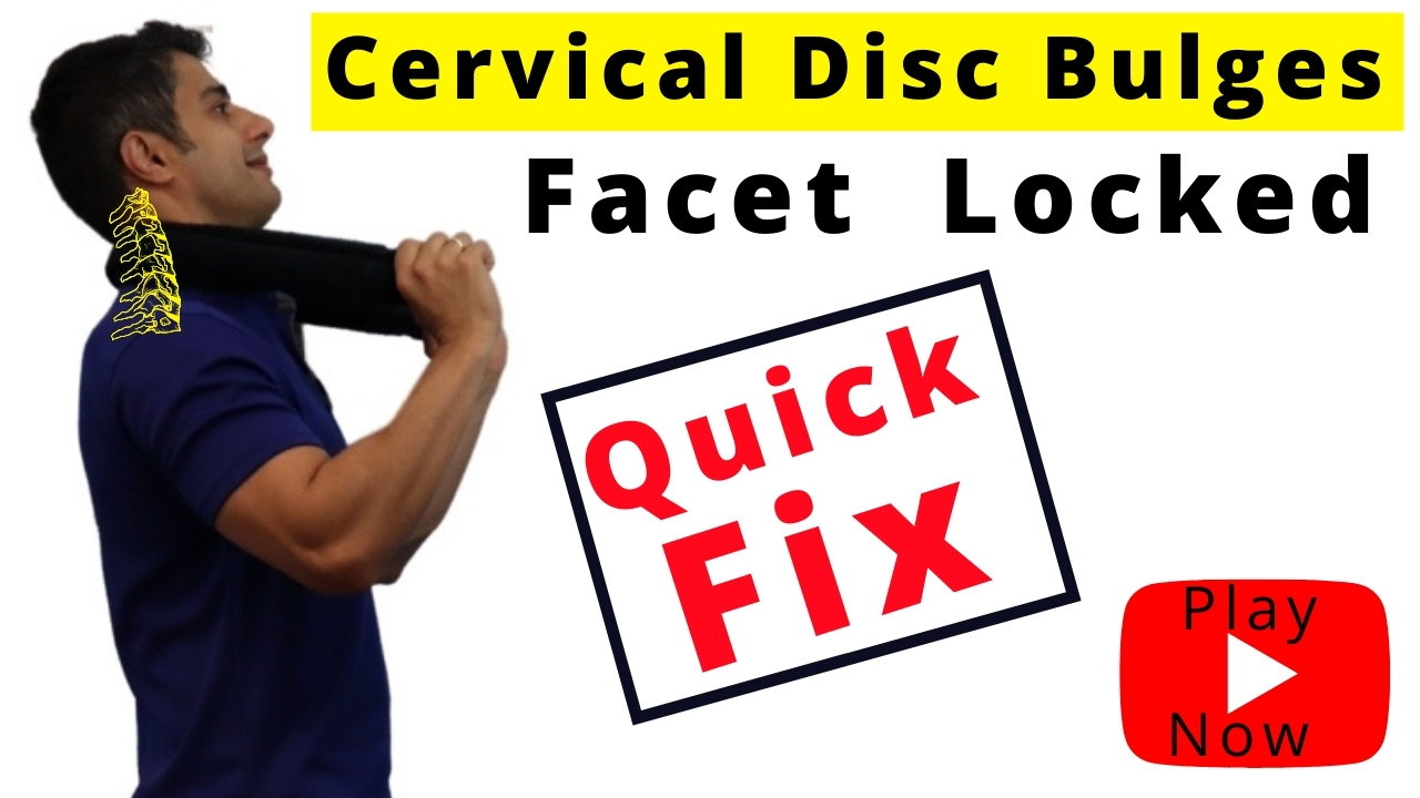 Cervical Disc Bulge and Cervical Facet Lock pain Relief
