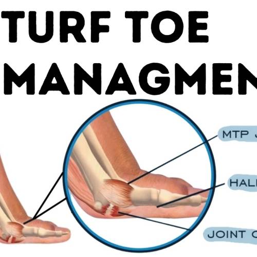 Turf Toe Managment