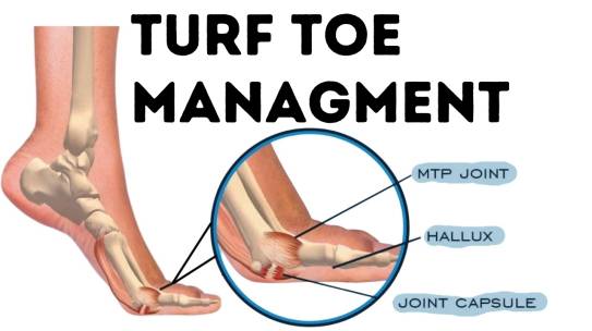 Turf Toe Managment