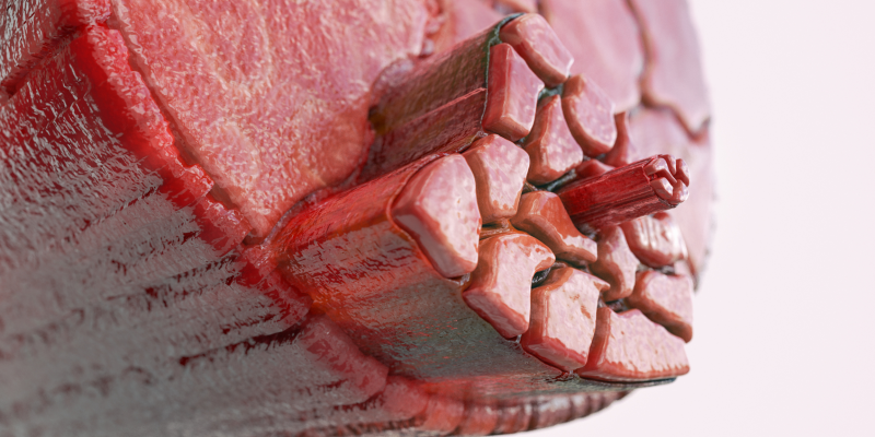 Delayed onset muscle soreness (DOMS)